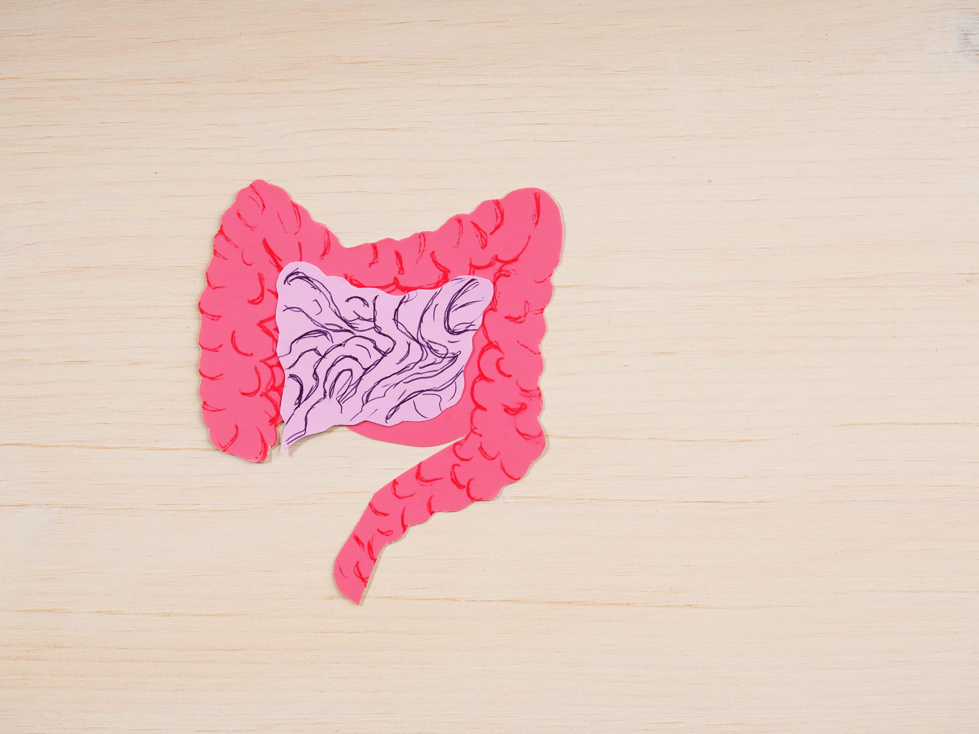 Common stomach bug linked to 22% of bowel cancer cases