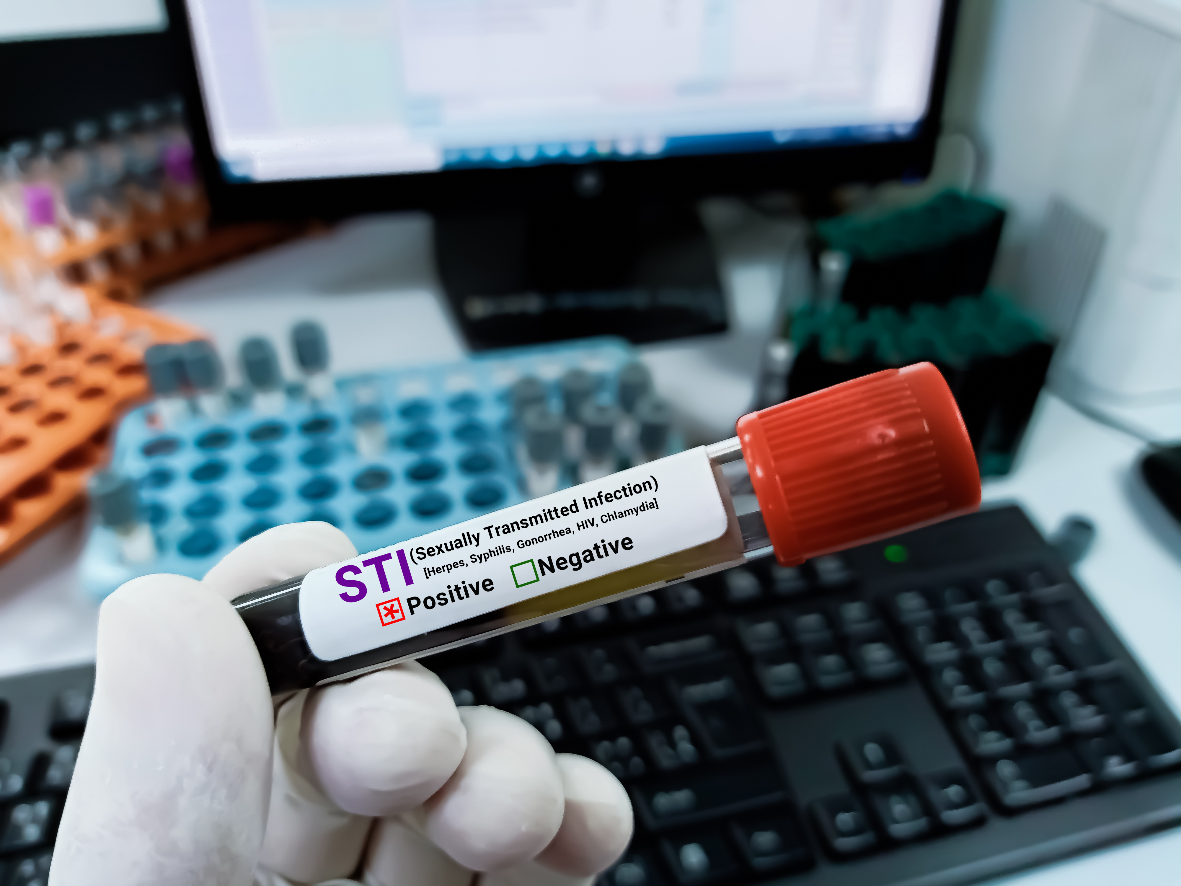 STIs can show up in unexpected places like eyes, hands and throat