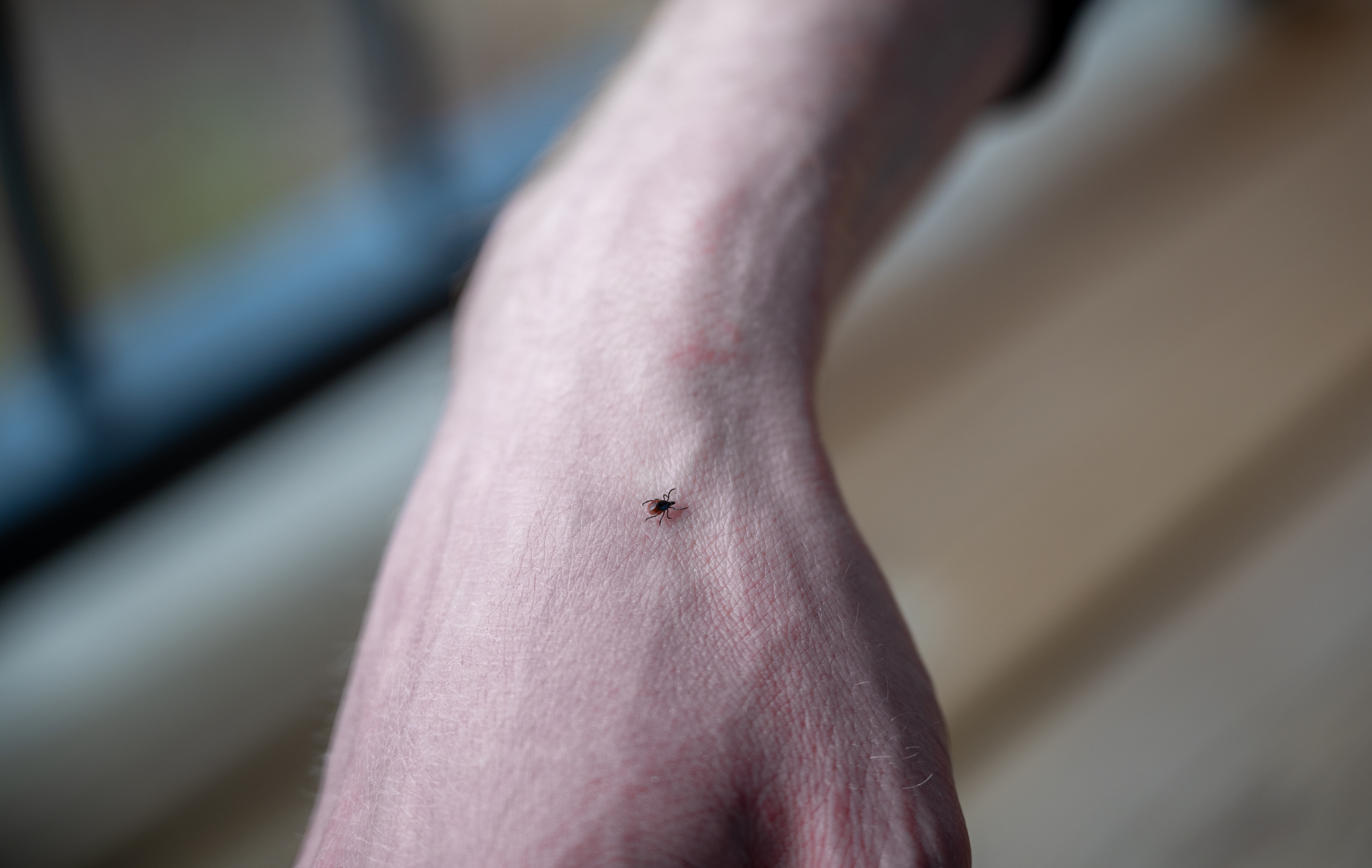 Mansfield man Peter Murphy spent four days in coma after spider bite