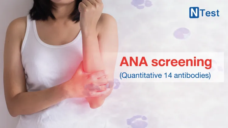 30.009_T067_-ANA-screening-_Quantitative-14-antibodies__NTest_Sep_2023.webp
