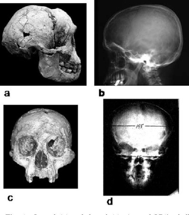 Homo floresiensis