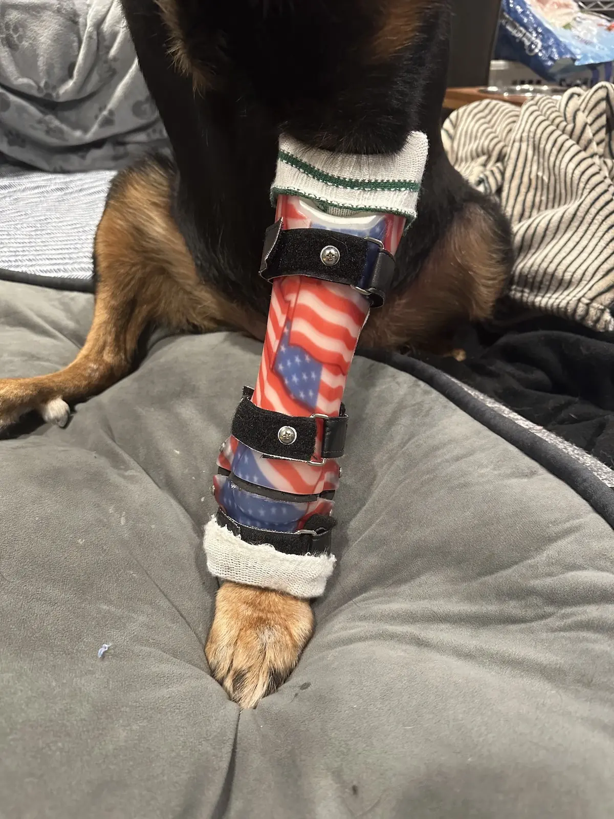 Wrist Brace