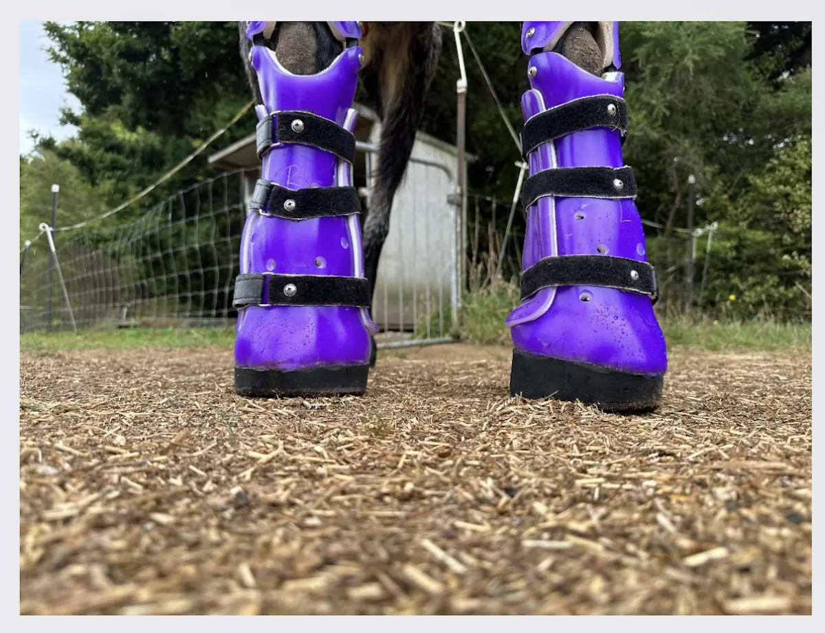 Bilateral Prosthetics