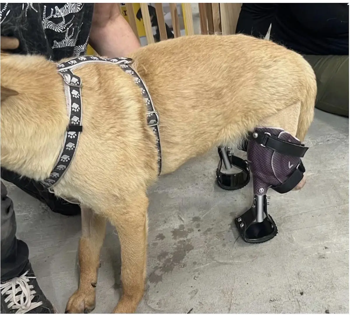 Bilateral Full Limb Prosthetic