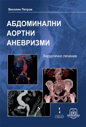 Корица на „Абдоминални аортни аневризми. Хирургично лечение“