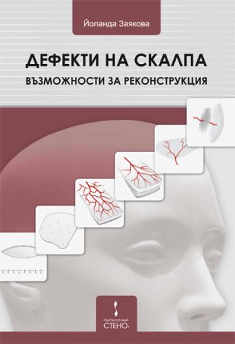 Корица на „Дефекти на челото и скалпа - възможности за реконструкция“