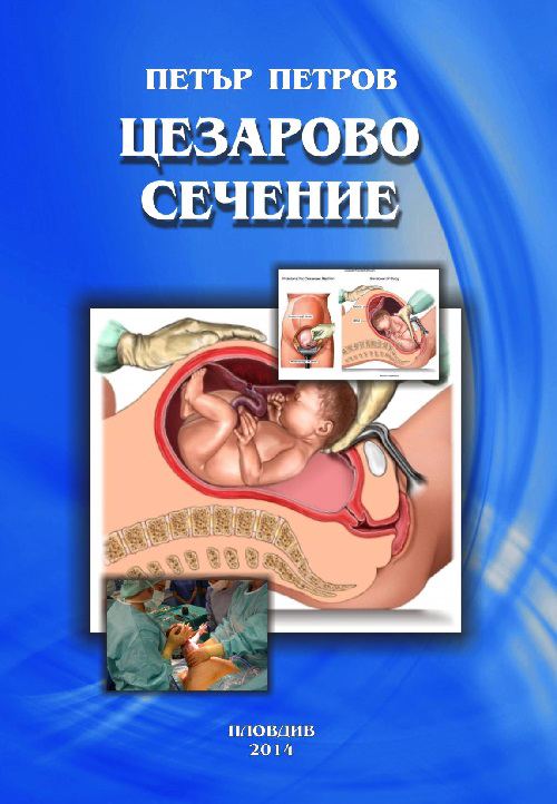 Корица на „Цезарово сечение“