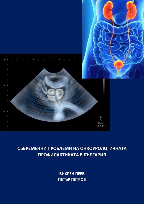 Корица на „Съвременни проблеми на онкоурологичната профилактиката в България“