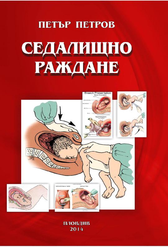 Корица на „Седалищно раждане“