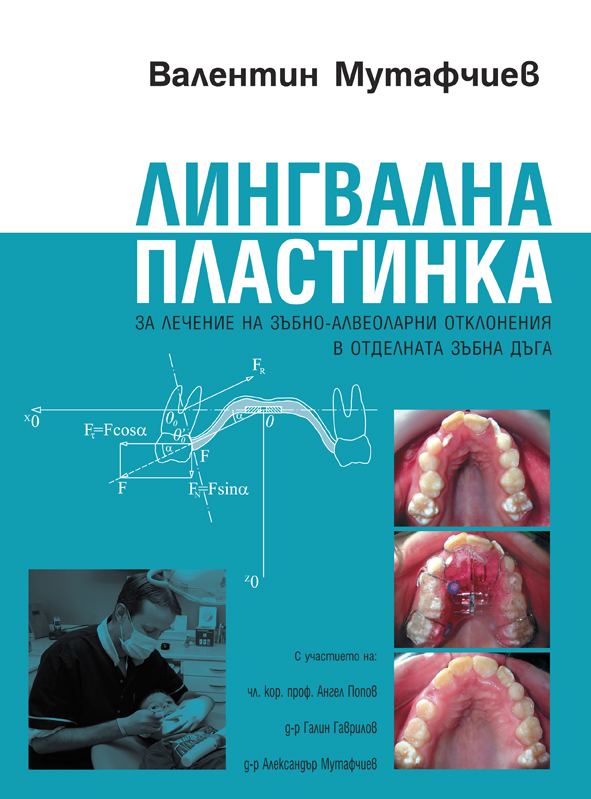 Корица на „Лингвална пластинка“