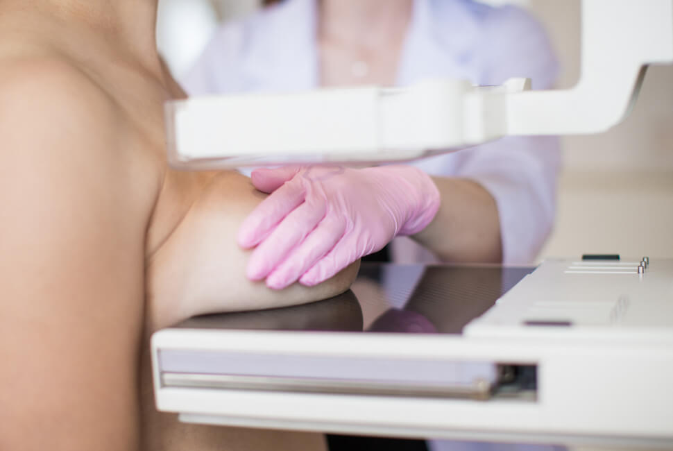 Imagem mostra mulher fazendo mamografia, que é muito importante para o câncer de mama.