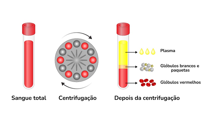 A centrifugação do sangue, que separa o plasma, as células vermelhas e brancas, é um exemplo