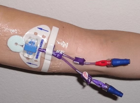 What is a PICC Line and Why Do Patients Need It?
