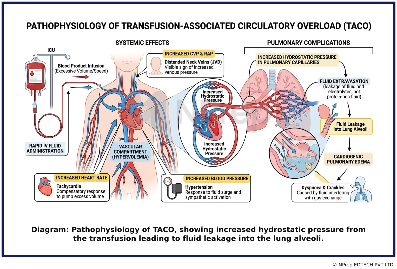 Visual explanation — Related Visual