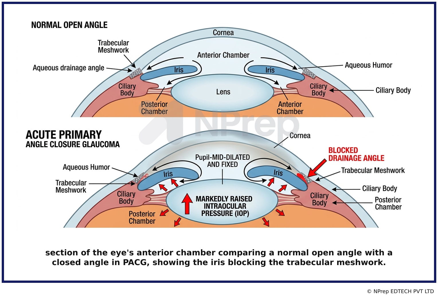 Visual explanation — Related Visual