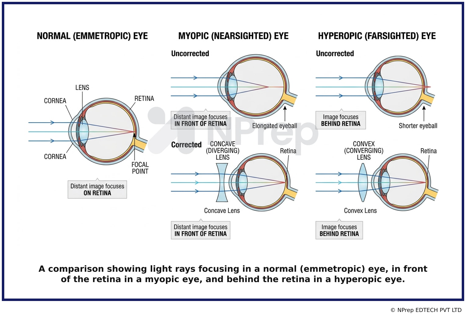 Visual explanation — Related Visual