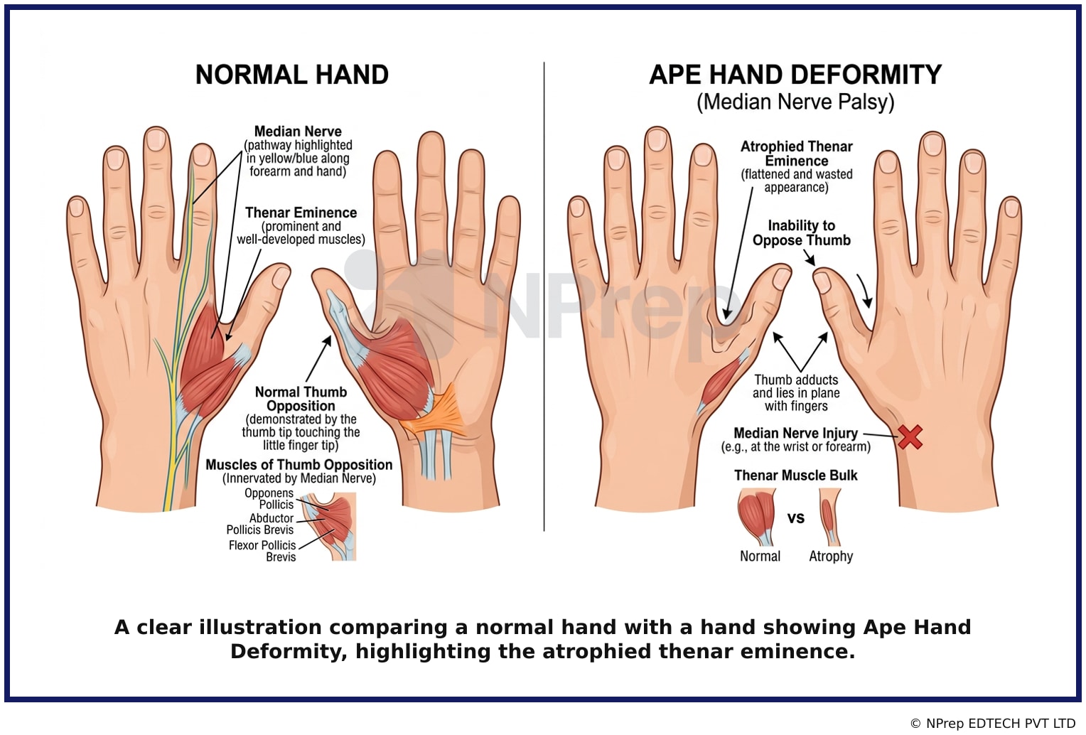 Visual explanation — Related Visual