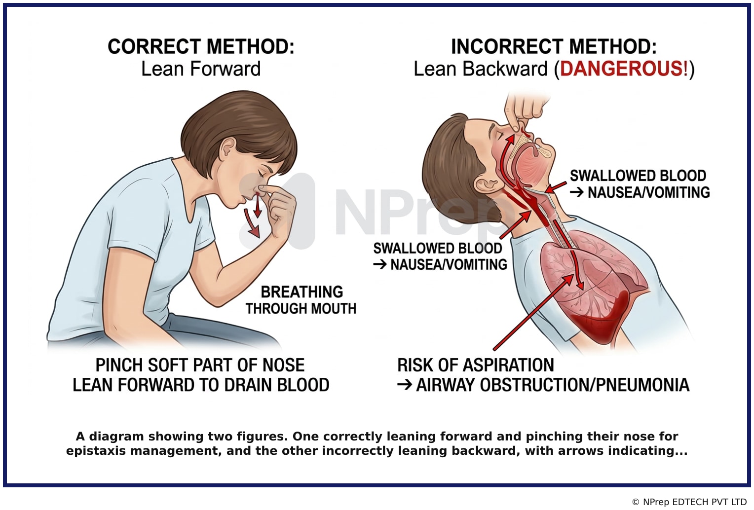 Visual explanation — Related Visual