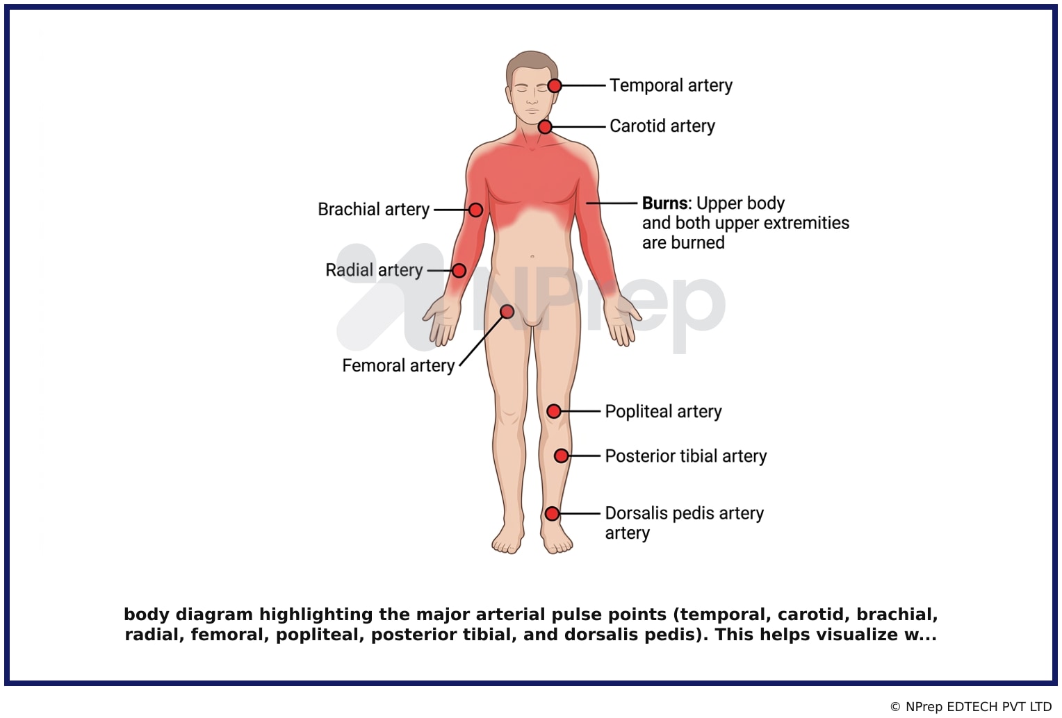 Visual explanation — Related Visual
