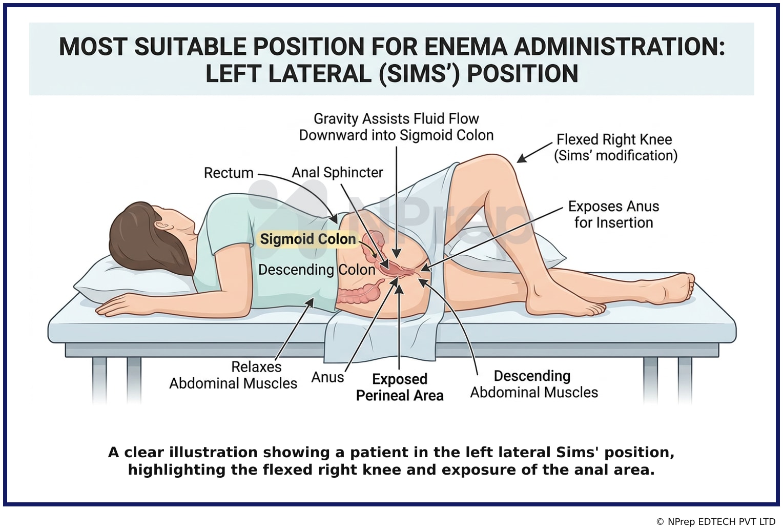 Visual explanation — Related Visual