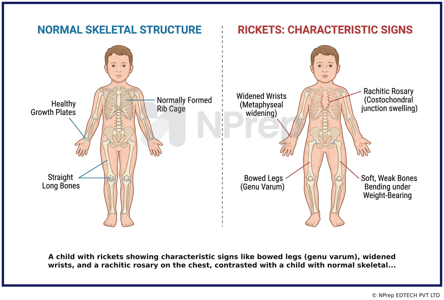 Visual explanation — Related Visual