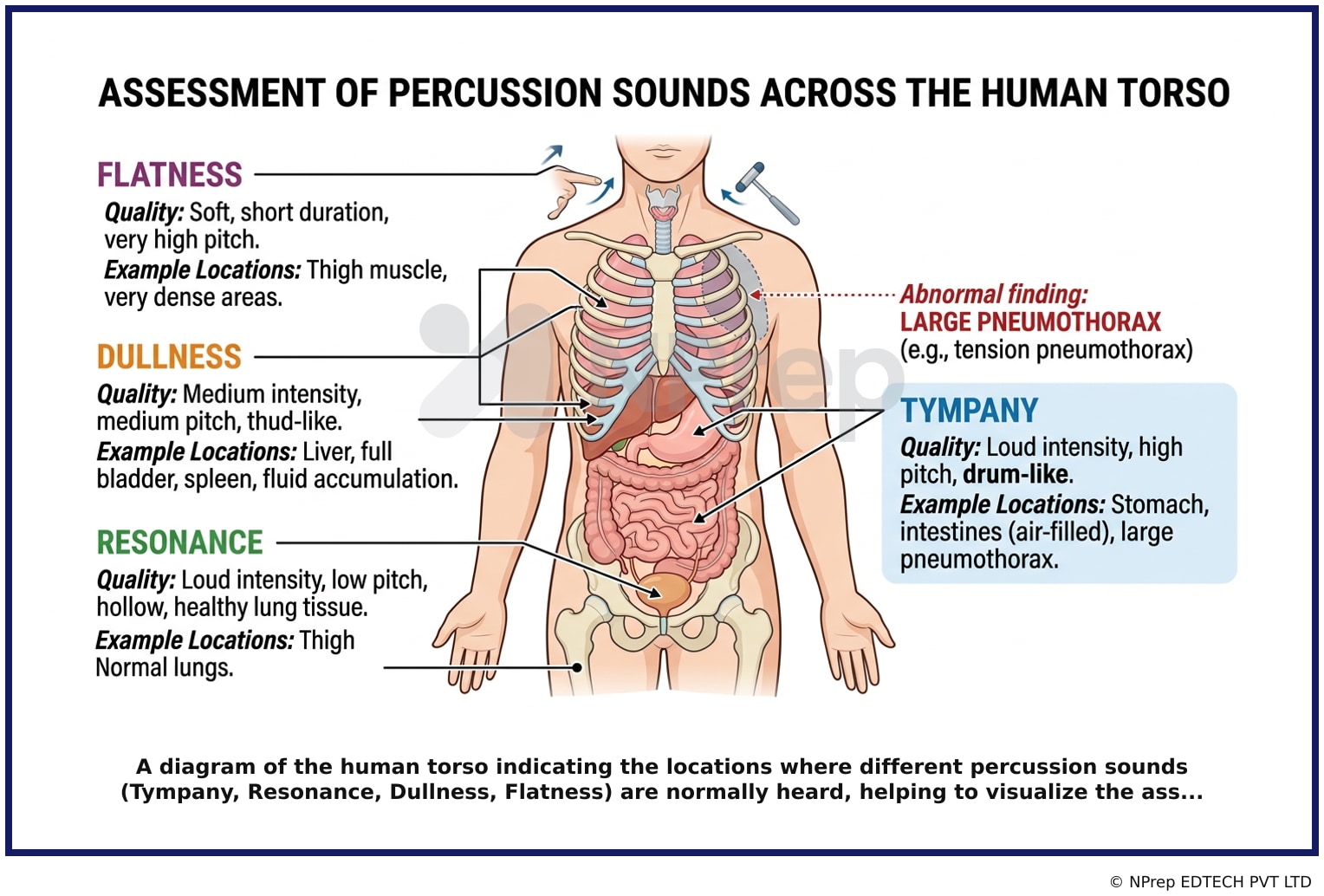 Visual explanation — Related Visual