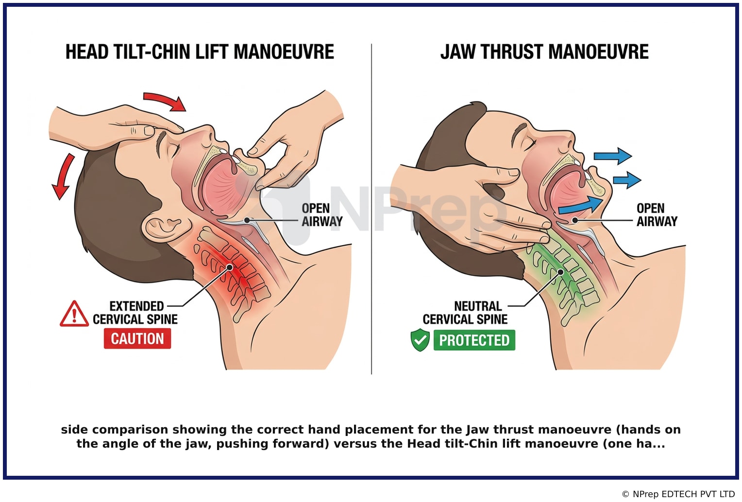 Visual explanation — Related Visual