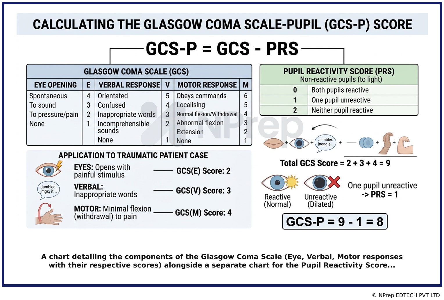A chart detailing the components of the Glasgow Coma Scale Eye, Verbal, Motor responses with their respective scores alongside a separate chart for the Pupil Reactivity Score...