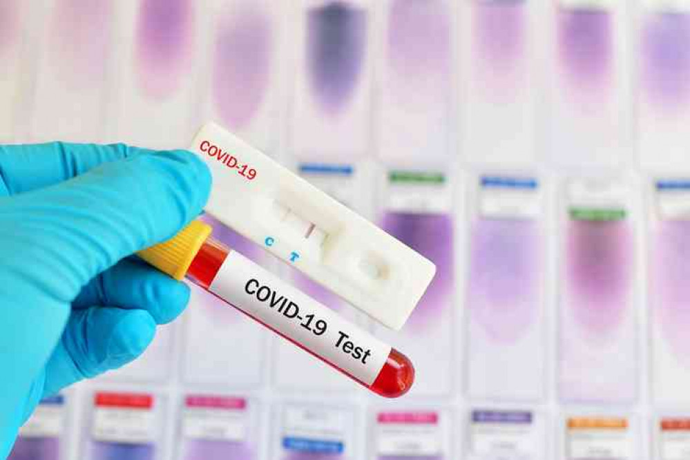 Coronavirus testing : file photo