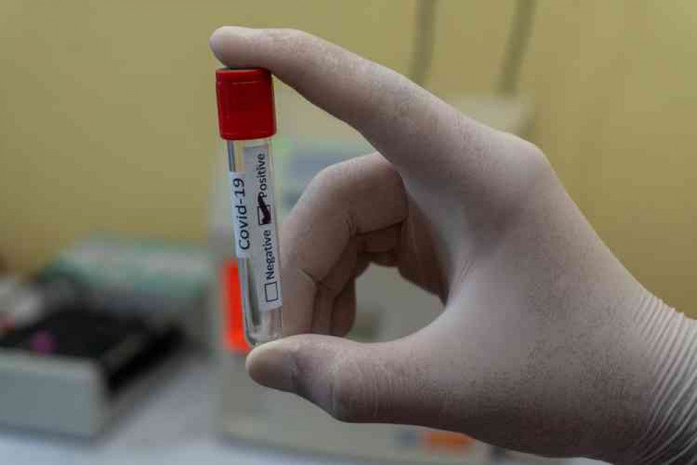 Coronavirus positive test. File Photo by Prasesh Shiwakoti (Lomash) on Unsplash
