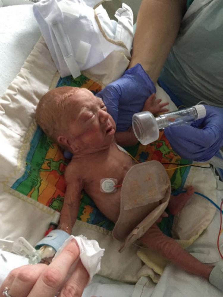 Freddie being treated at Addenbrooke's Hospital.