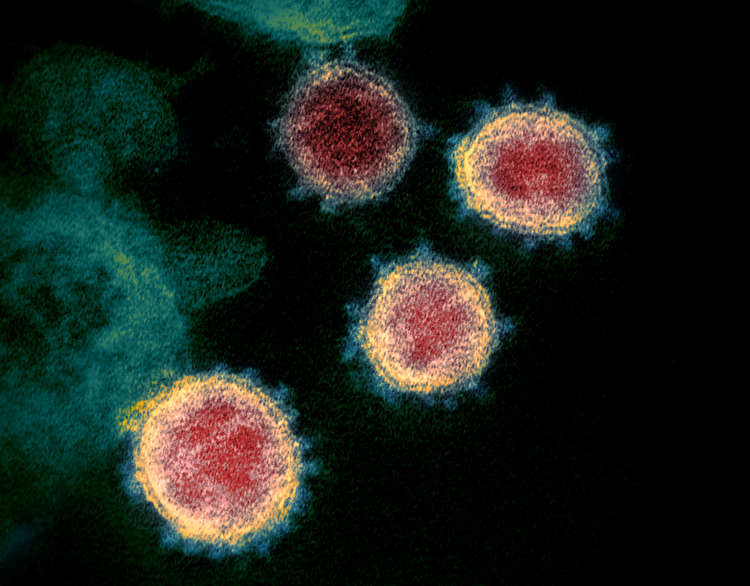 Congleton: We're back in triple figures for positive tests of the virus. (Image - CC Unchanged NIAD bit.ly/3lbE1Wi)