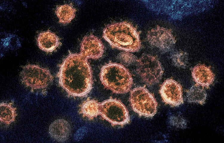 There was an increase of over 74% in the number of new coronavirus cases. Image Credit: NIH Image Gallery