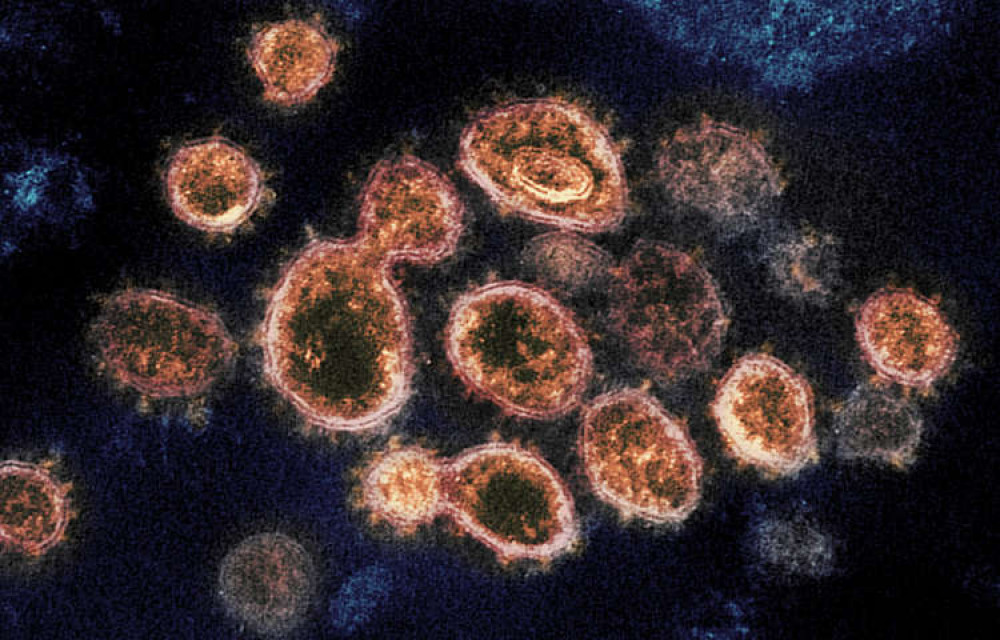 There was a decrease of over 12% in the number of new coronavirus cases. Image Credit: NIH Image Gallery/Flickr