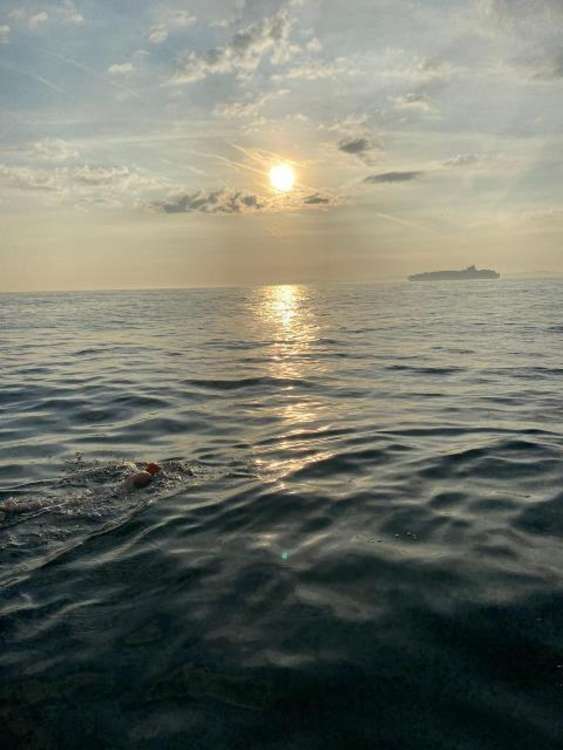 Dervla thought she was hit by a jellyfish mid-swim. Credit: London North West University Healthcare.