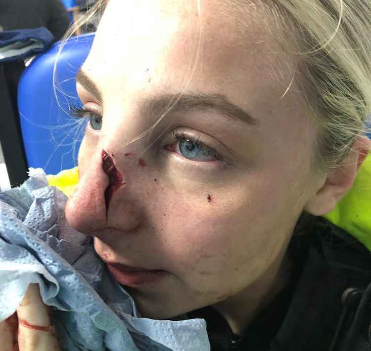 Maddie suffered terrible injuries just after the attack