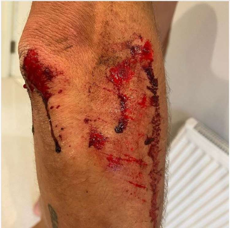 The aftermath of the attack on British cyclist Alexander Richardson last Thursday (Image: @alexrichitaly)