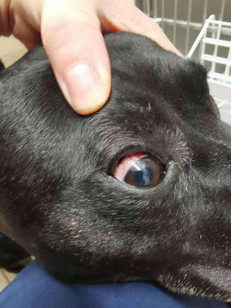 Angel suffered haemorrhages to her eye.