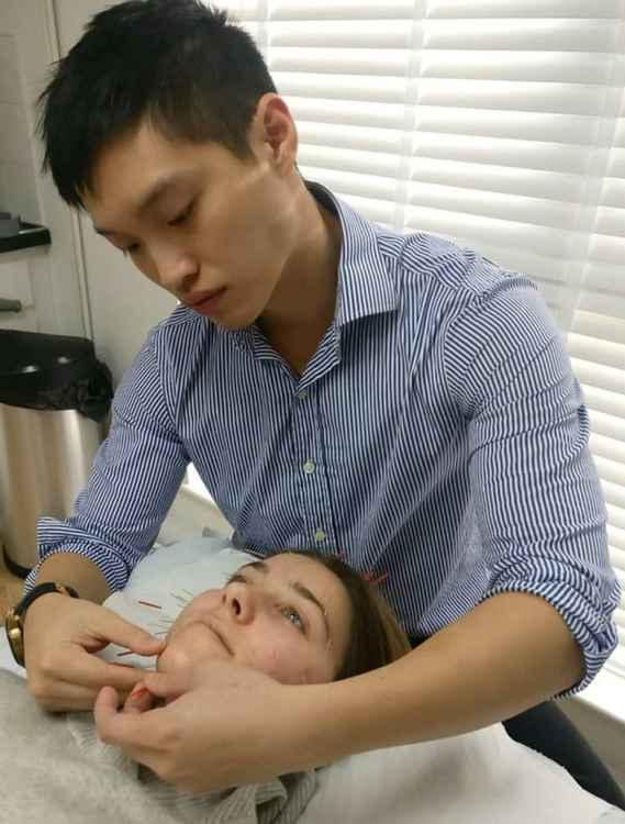 Physiotherapist Leon Li carries out facial acupuncture for acne scarring.