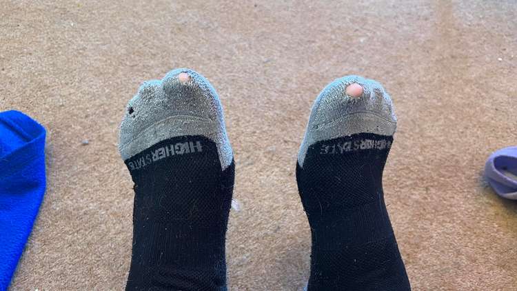 Regular running takes its toll on Simon's socks!