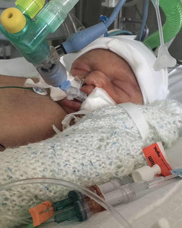 Archie fought for his life during his first few months and required extensive care in hospital.