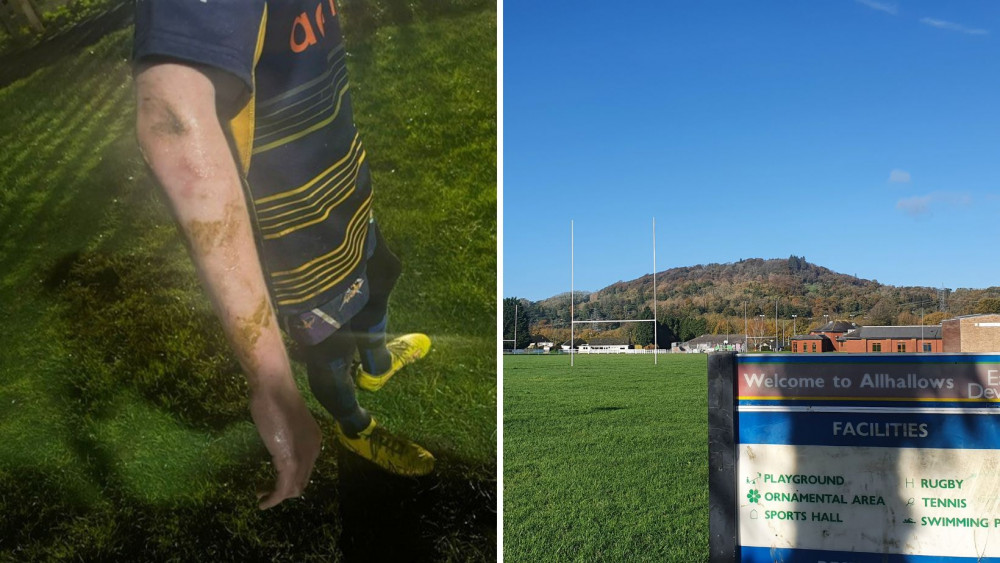 L: A player with dog mess on his arm (Credit: Jeremy Rice) L: Allhallows Playing Fields 