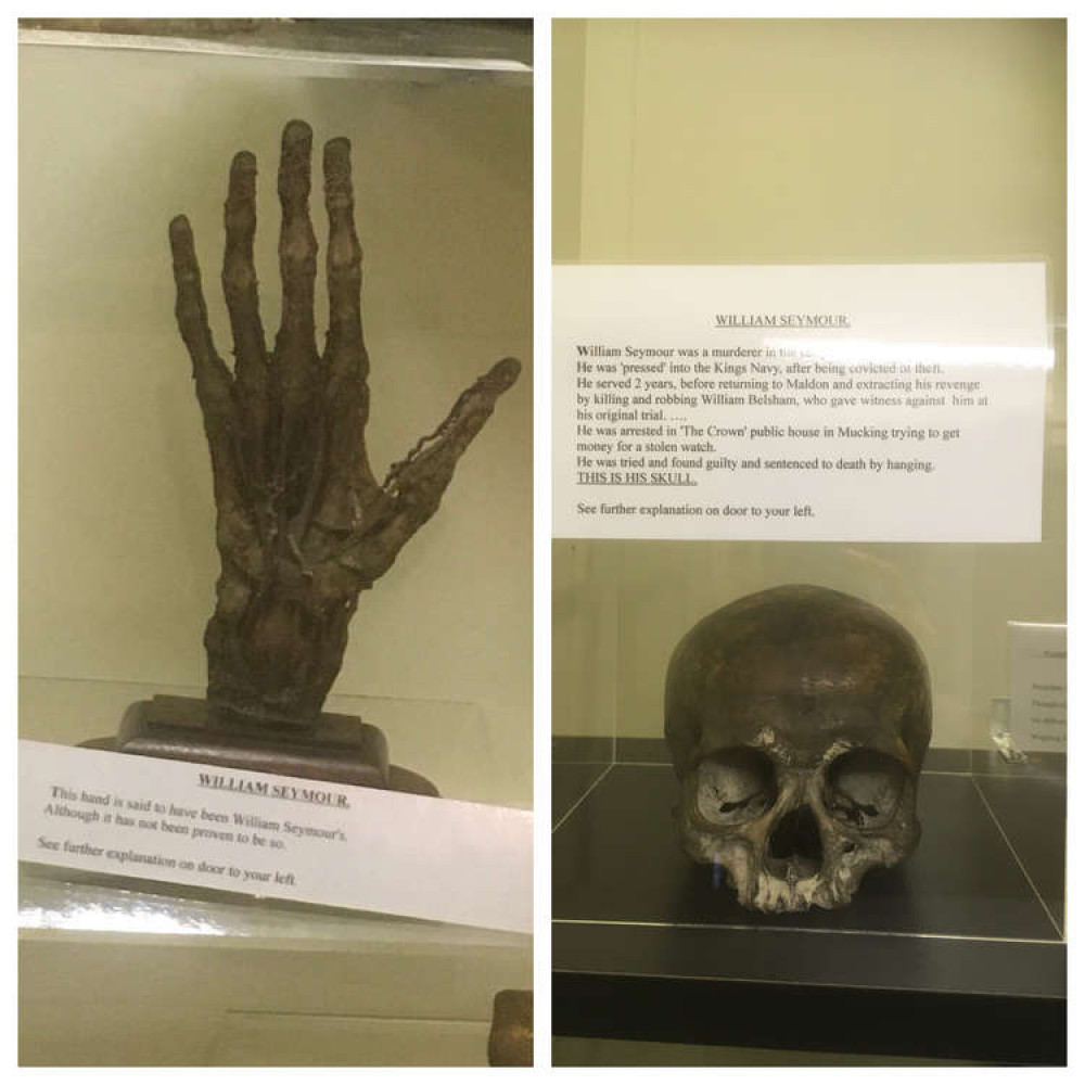The skull and hand in Maldon's Museum in the Park