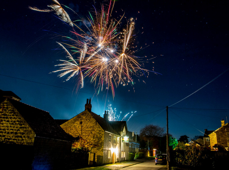 NHS gives advice over burns and scalds ahead of bonfire weekend. (Photo: SWNS)