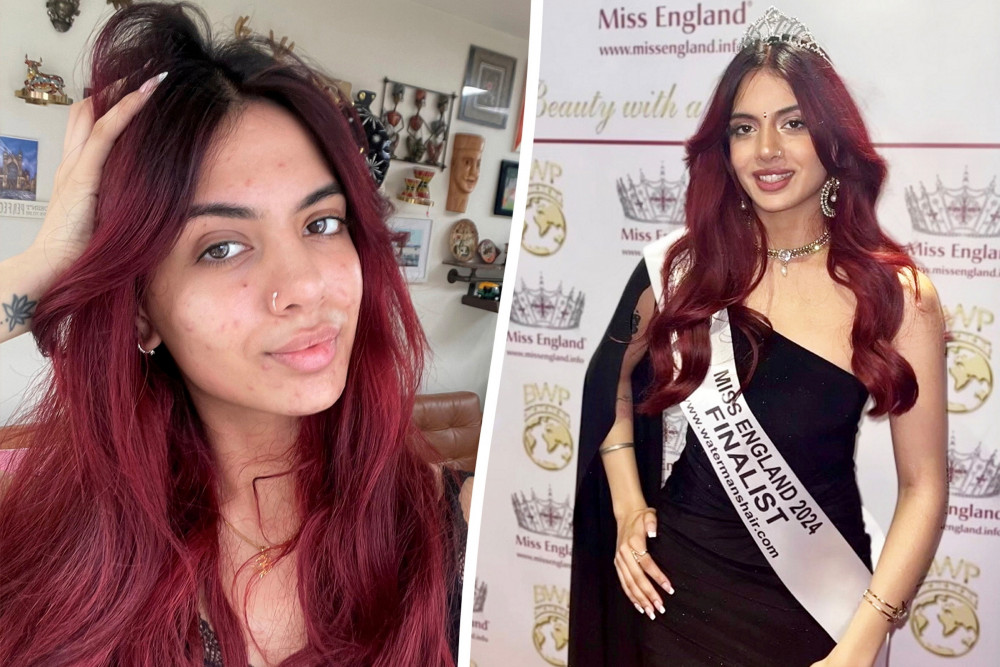 A Miss England finalist from Southall, Ealing has taken part in a Instagram v Reality campaign promoting natural beauty (credit: SWNS).
