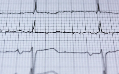 Przepukliny w odcinku piersiowym kręgosłupa. Czy powodują dolegliwości bólowe?