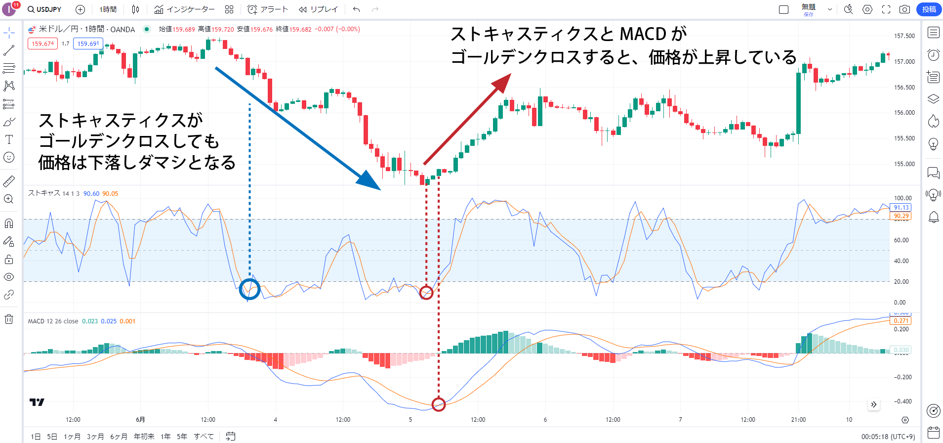 ストキャスティクス×MACDを組み合わせた取引手法