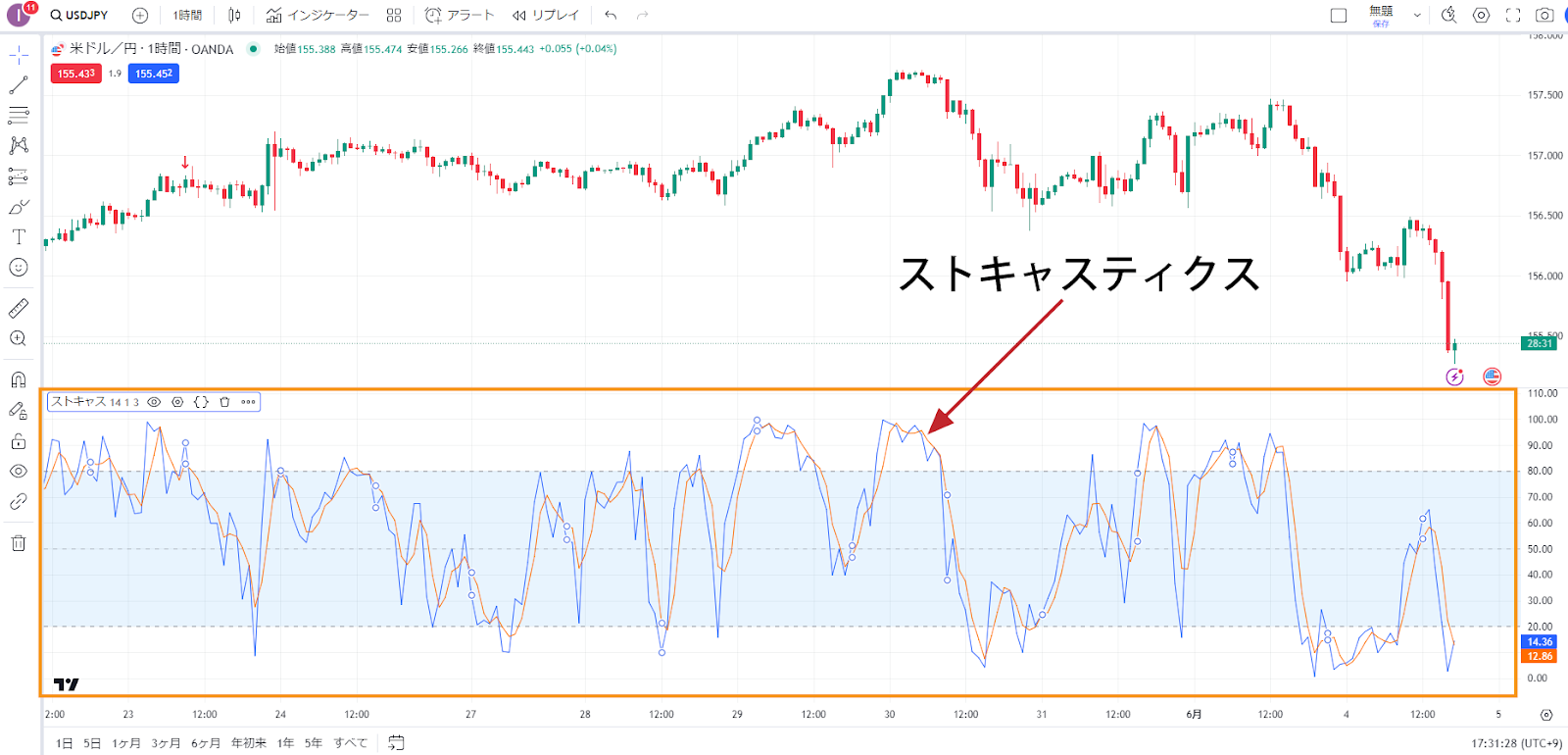 ストキャスティクス