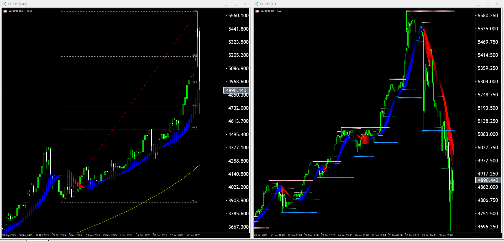 【金(XAU)】本日（2026年2月2日）のチャートテクニカル分析