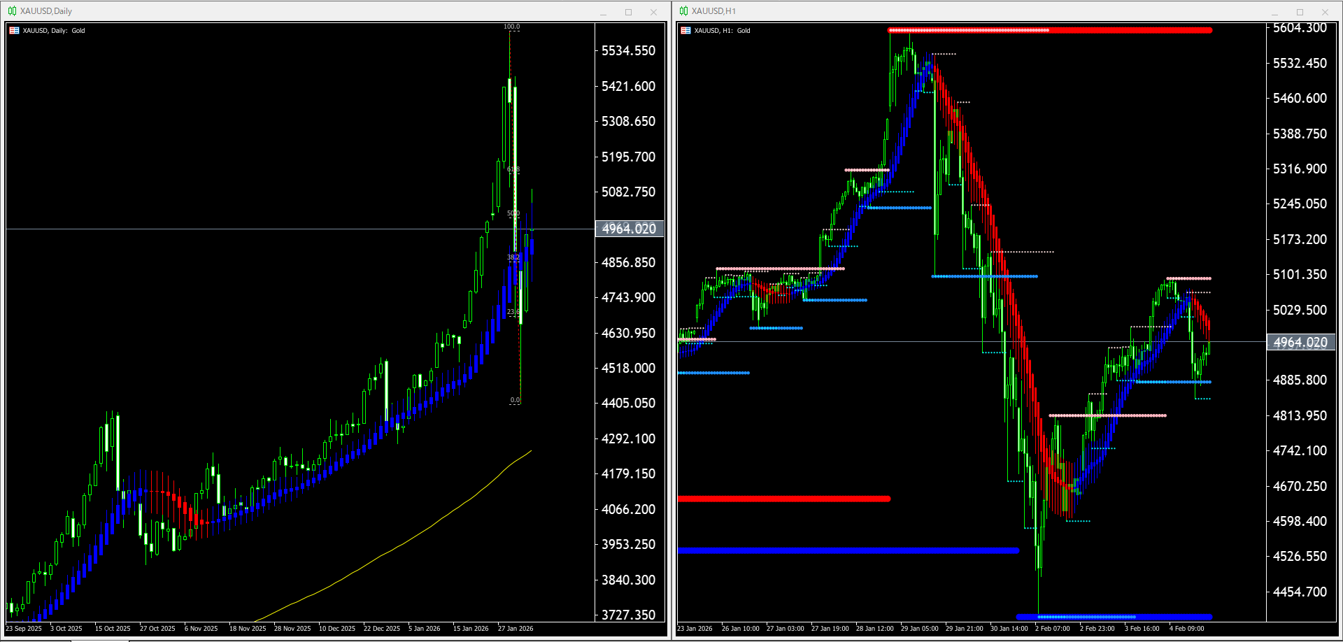【金(XAU)】本日（2026年2月5日）のチャートテクニカル分析2026/02/05